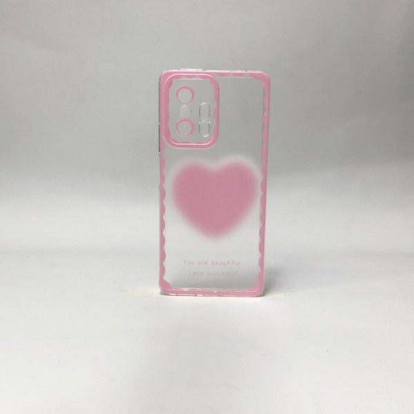 Capa Silicone Com Coração Rosa Claro  - Xiaomi 11T 
